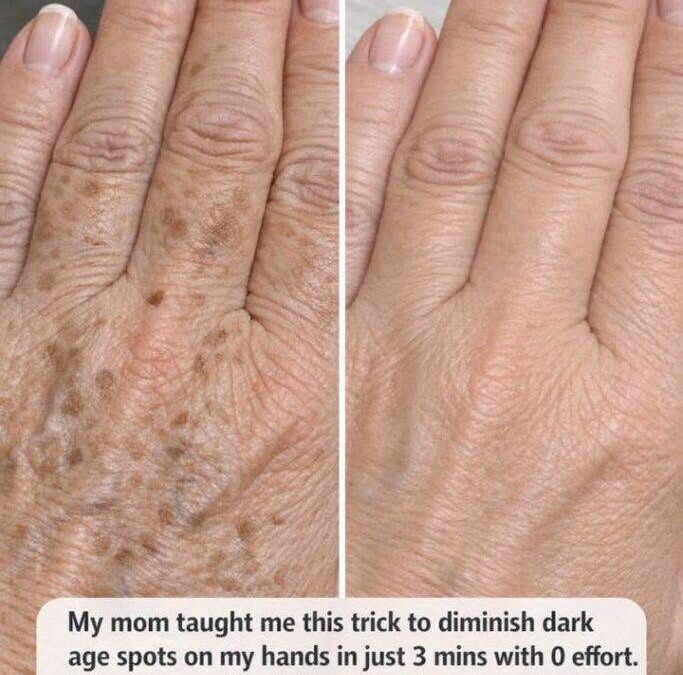Can You Really Fade Dark Age Spots on Your Hands in Just 3 Minutes? Here’s What Actually Works